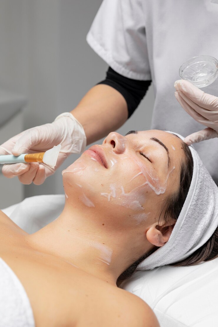 Kimyasal Peeling